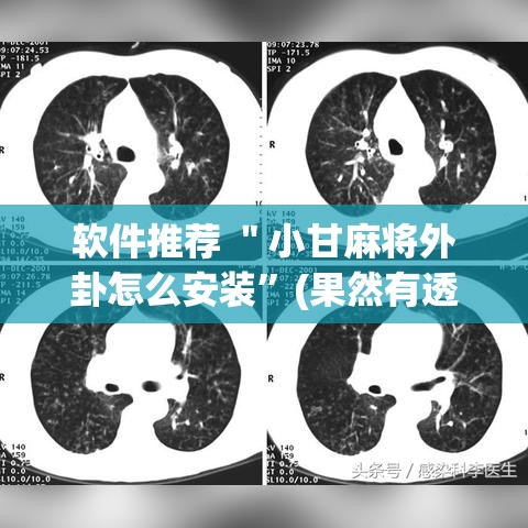 软件推荐 ＂小甘麻将外卦怎么安装	”(果然有透视挂)
